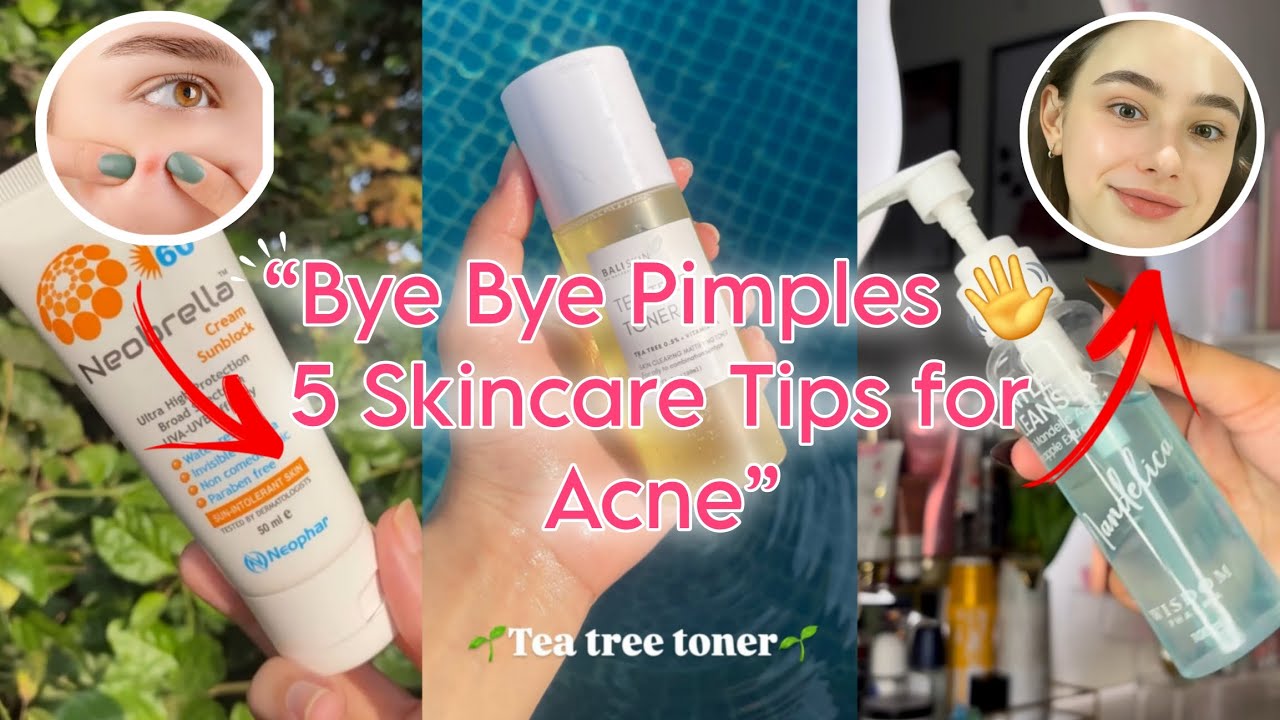 “5 Acne-Fighting Products You Need in 2025”