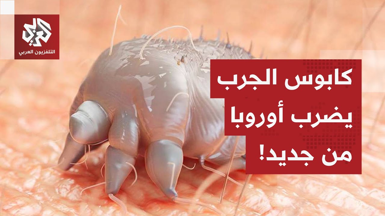 كابوس الجرب يضرب أوروبا من جديد.. انتشار محير في بريطانيا وفرنسا وألمانيا، ما القصة؟