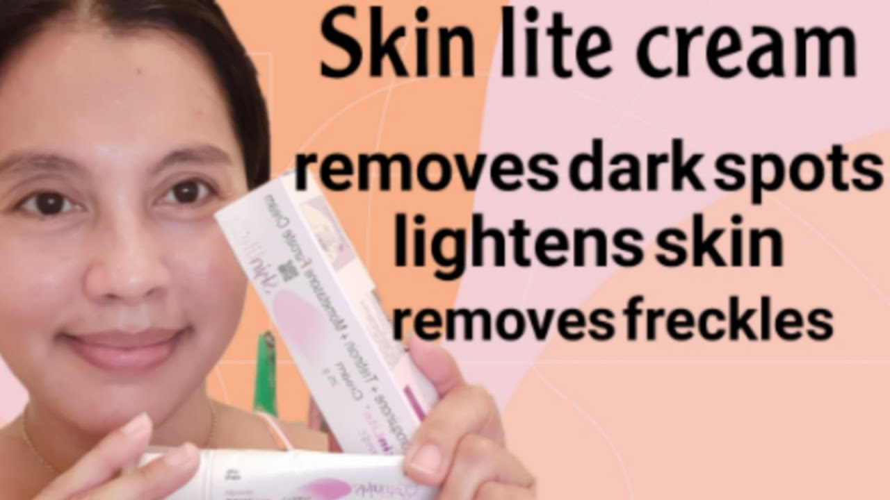 Skinlite cream Review naging effective ba sa pagwala ng pekas ko?