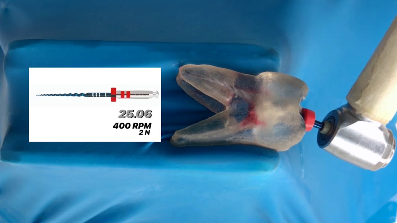 Instrumentação com limas rotatórias Sequence Rotatory File - MKLife