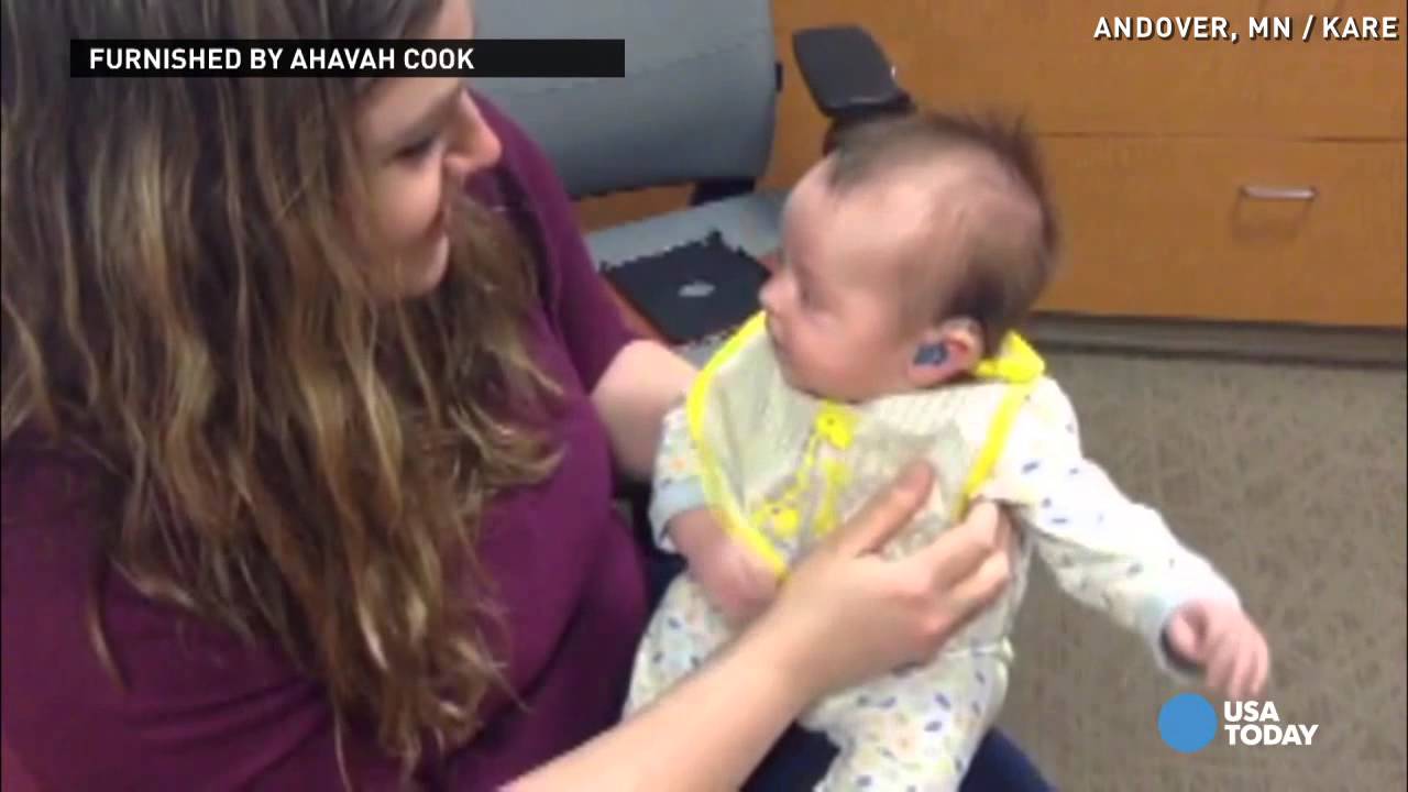 See 9-week-old baby hear mom for the first time
