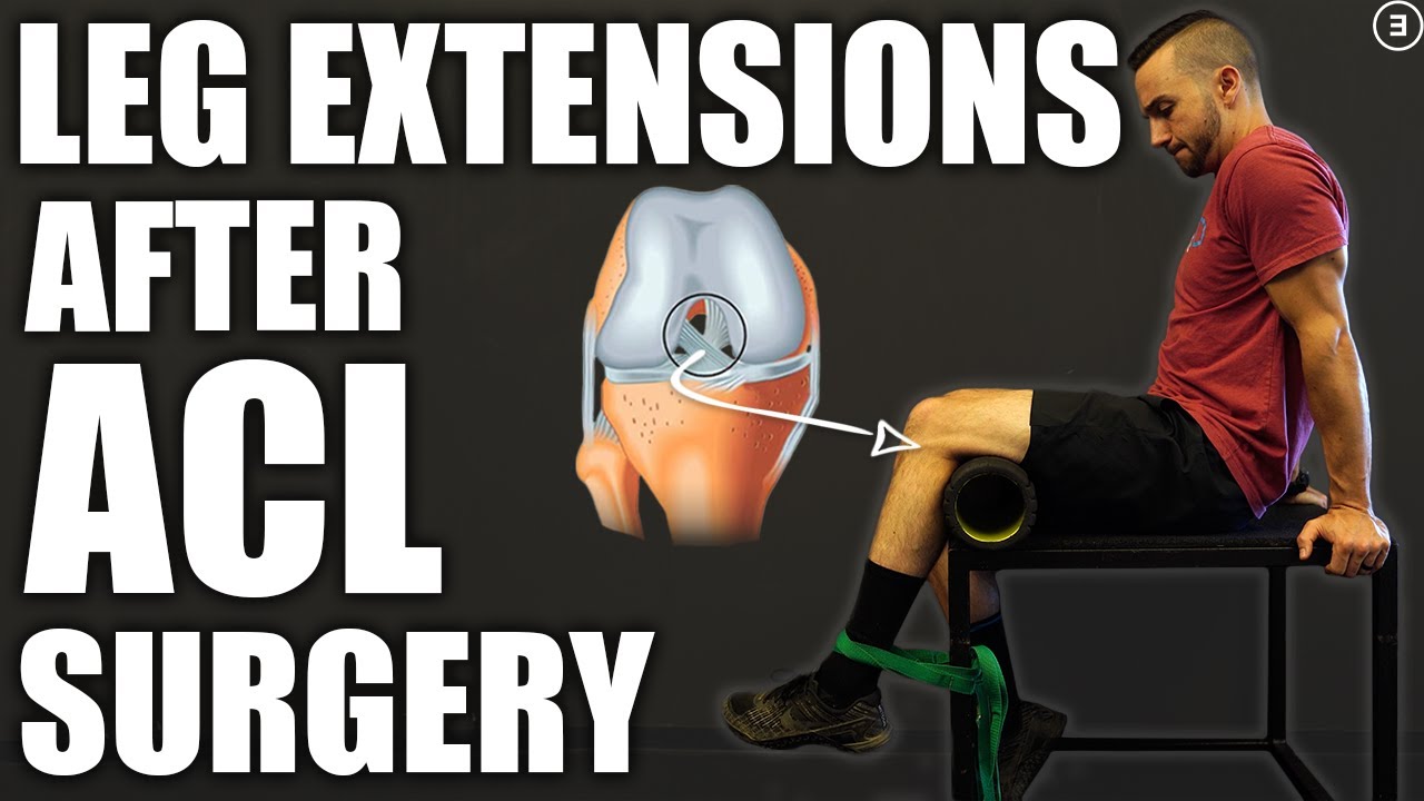 How To Program Leg Extensions Safely After ACL Rescontruction (3 Phases)