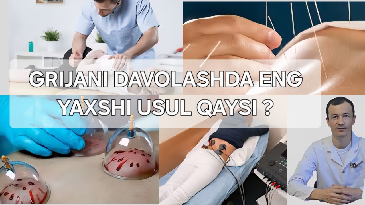 GRIJANI DAVOLASH USULLARI #mardonbekgafurov