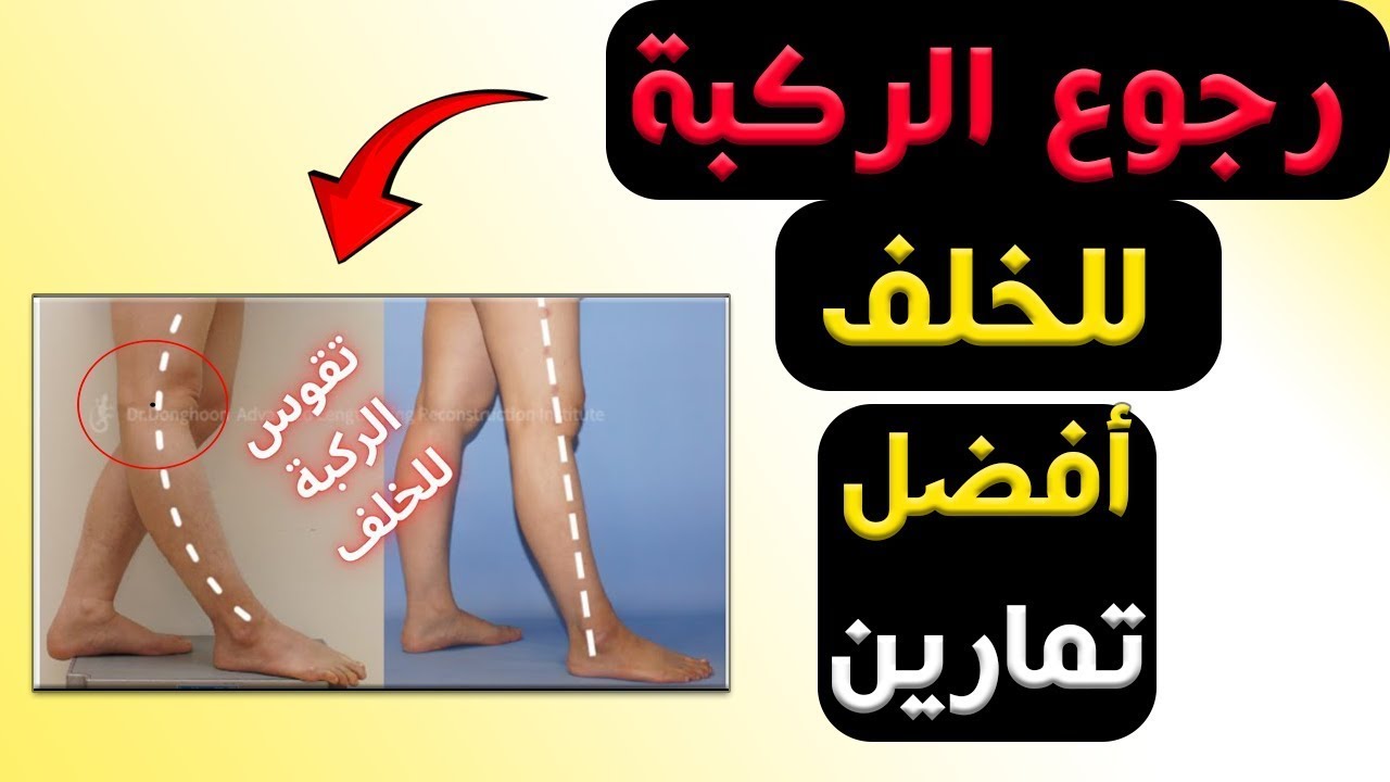 أفضل تمارين سهلة لعلاج رجوع الركبة للخلف | عالج امتداد الركبة للخلف - Genu Recurvatum Exercises