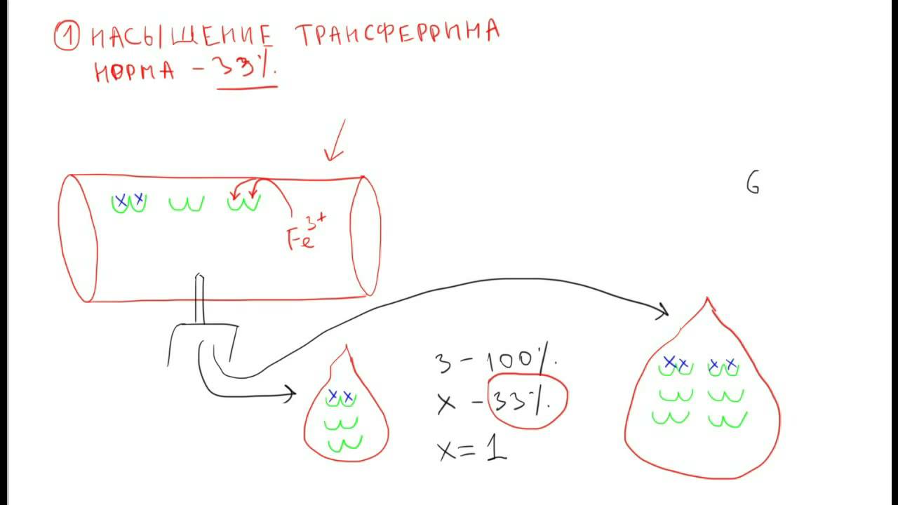 Железодефицитная анемия 2