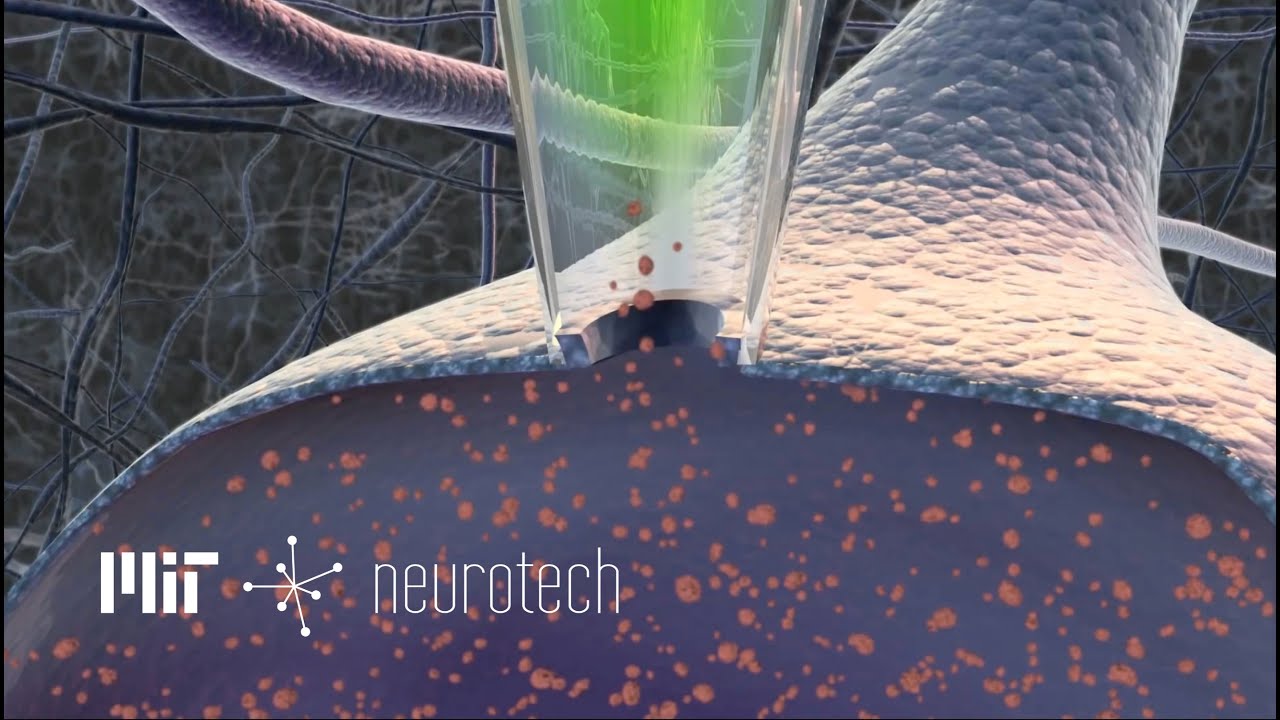 Neurotech 5: Tapping into Neurons (Autopatching)