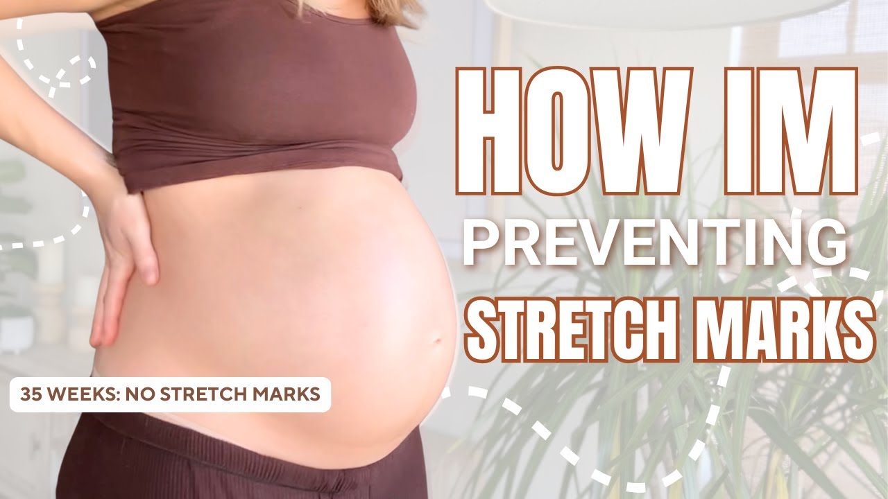 What I'm Using at 35 Weeks  Pregnant to Keep Stretch Marks Away
