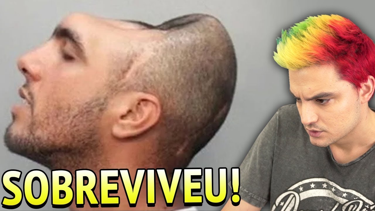 10 PESSOAS QUE SOBREVIVERAM [+10]