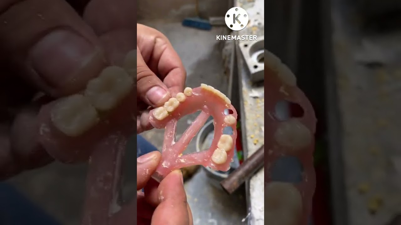 Cómo inyectar tu PRX3 fácil y sencillo 🫢