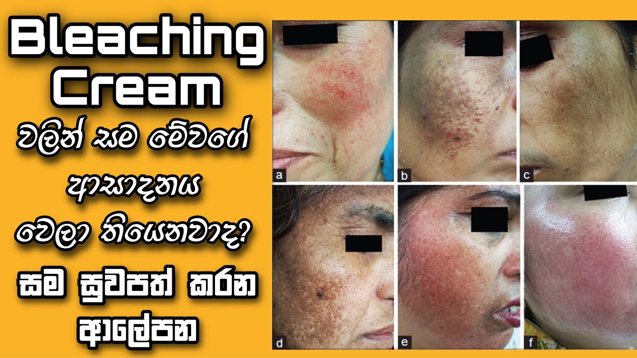 How to heal damaged skin