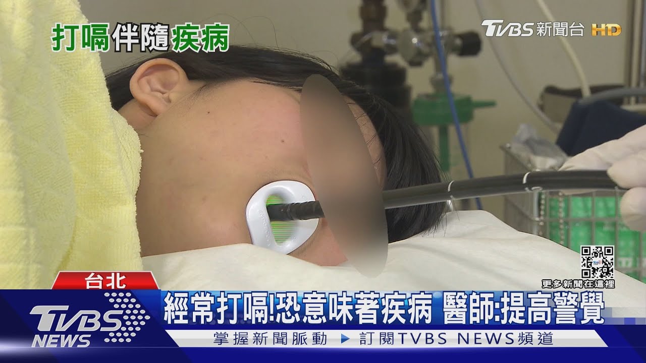 經常打嗝!恐意味著疾病 醫師:提高警覺｜十點不一樣20220228
