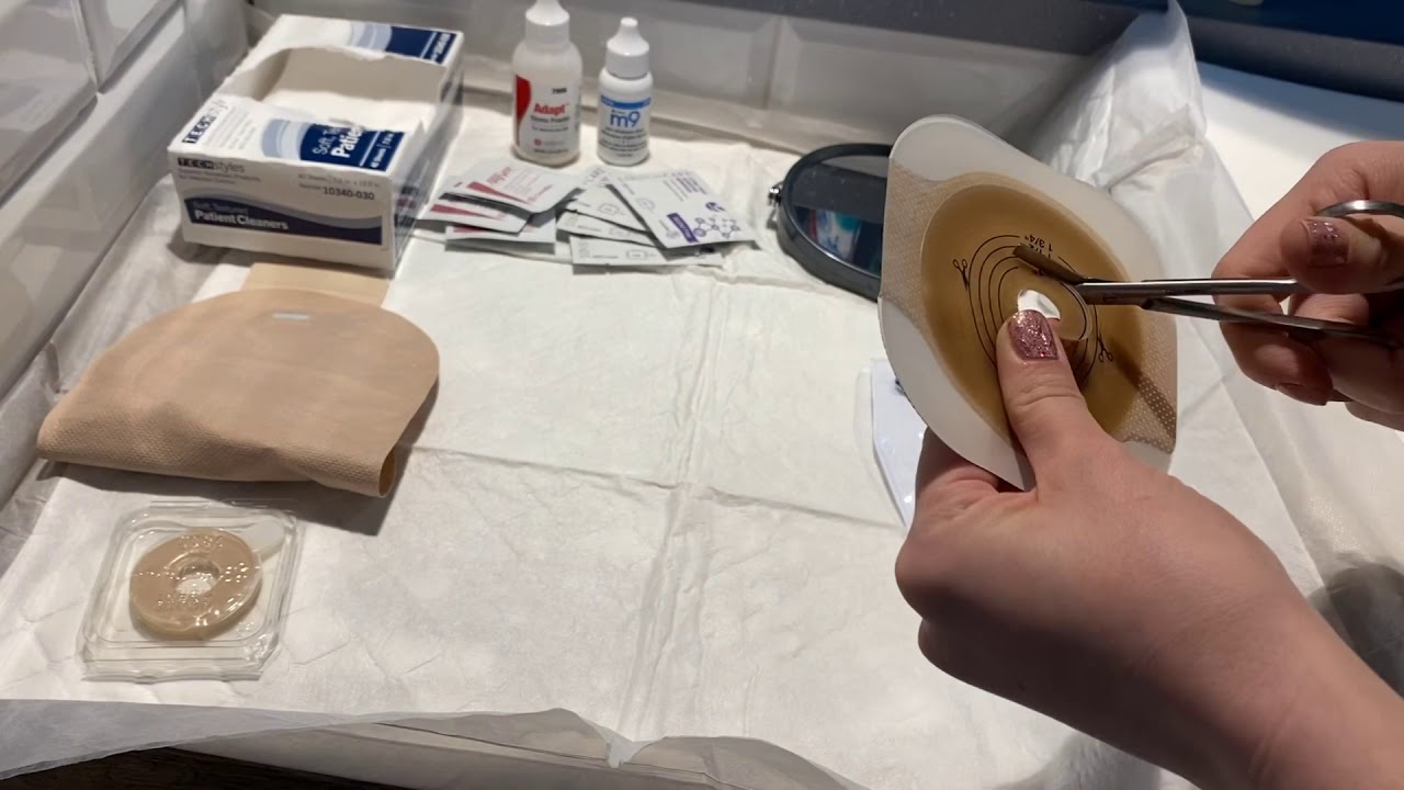 Ostomy Bag Change