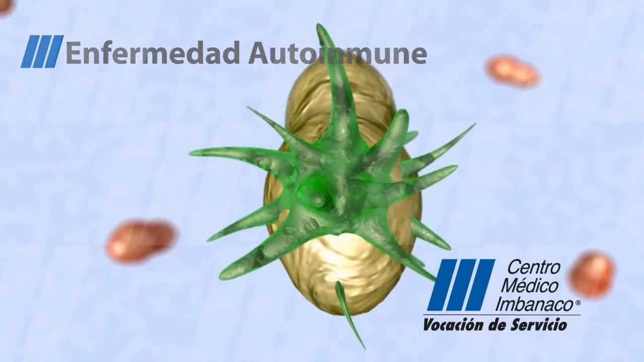 Lupus Eritematoso Sistémico