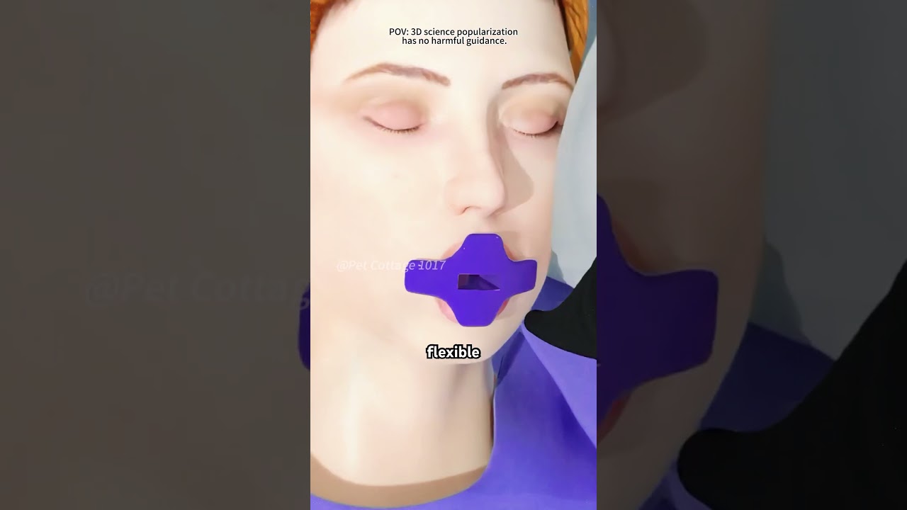 How Incisionless Fundoplication Surgery Is Performed (3D Animation)