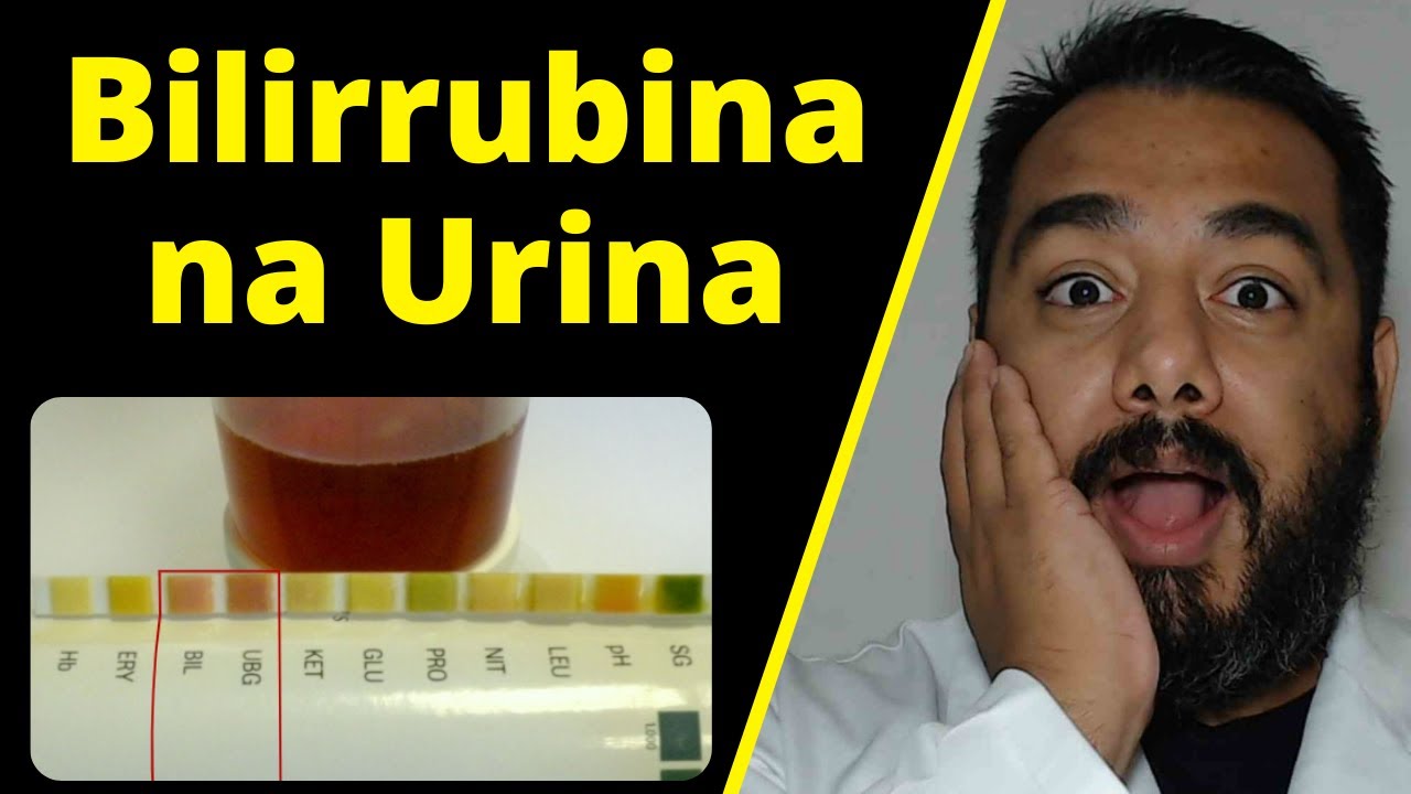 O que indica a elevação de bilirrubina na urina (bilirrubinúria)? O que é? Por que aparece na urina?