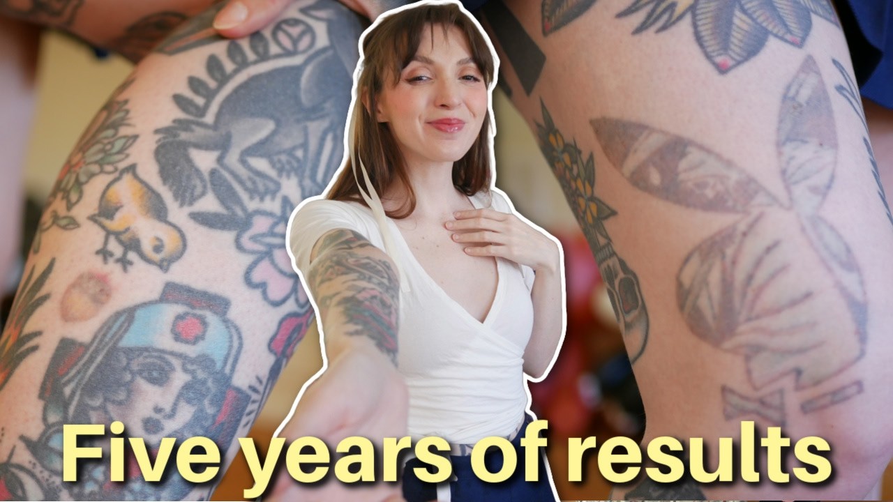 What Twenty Sessions of Tattoo Removal Looks like