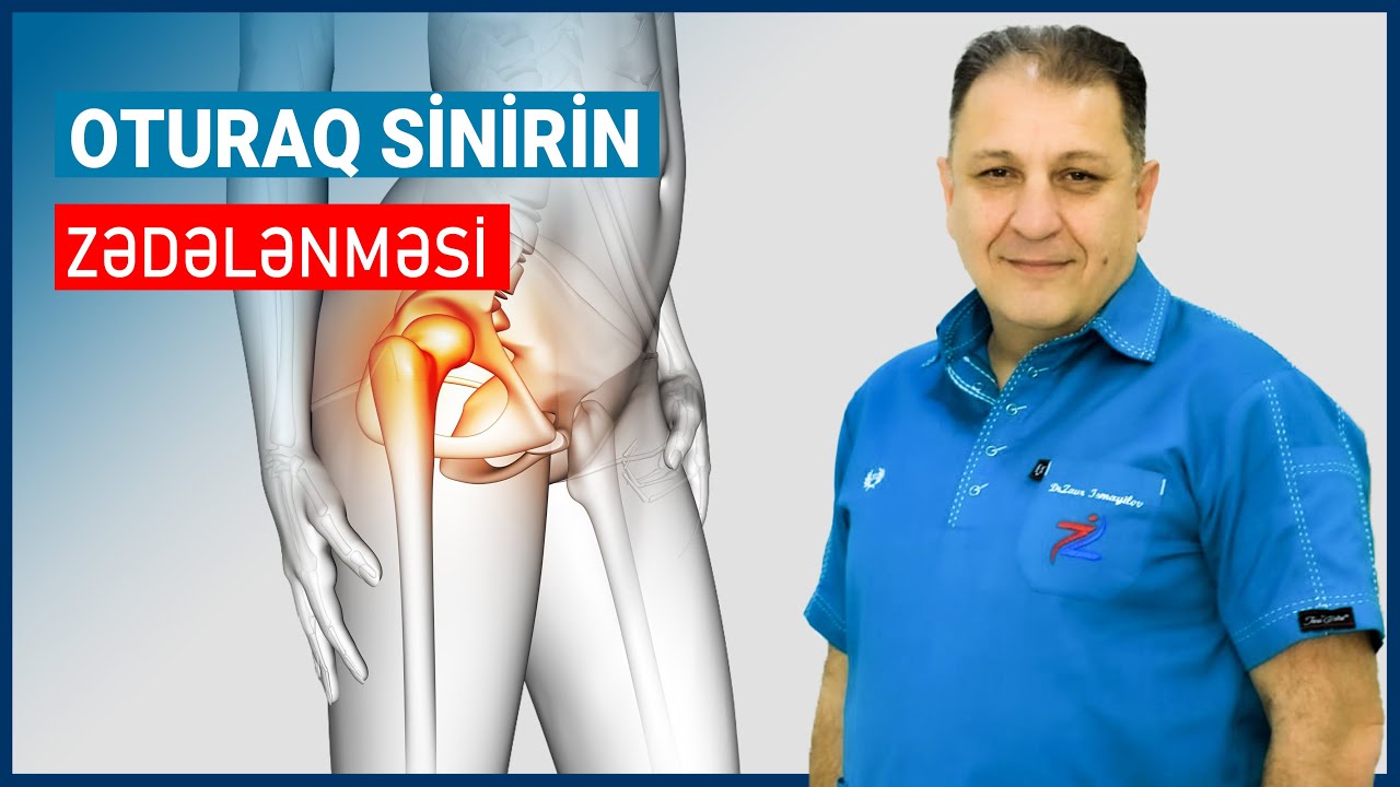Oturaq sinirin zədələnməsi - Piriformis sindromu |  Alqooq, ağrı həkimi Dr.Zaur Ismayılov