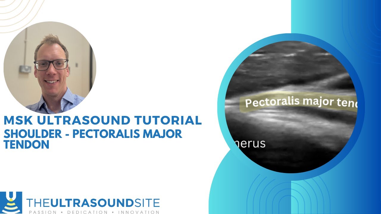 Step-by-step Pectoralis major tendon on MSK ultrasound