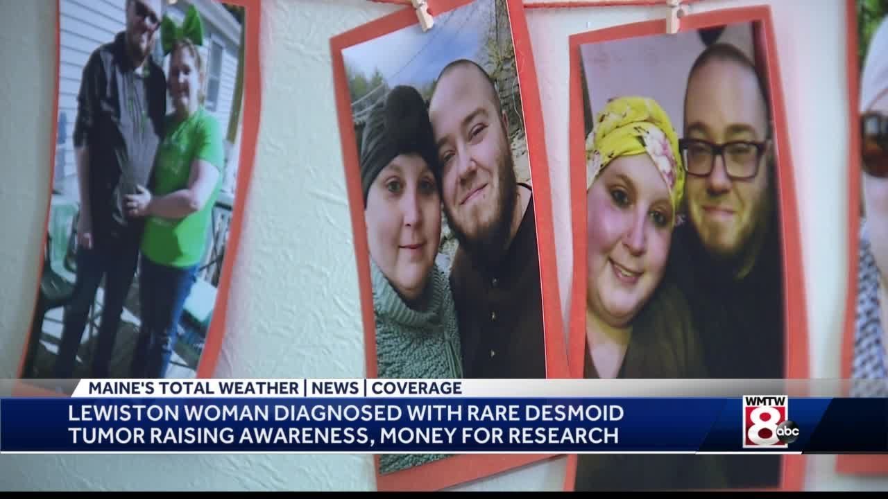Maine woman diagnosed with desmoid tumor raising awareness, money for research