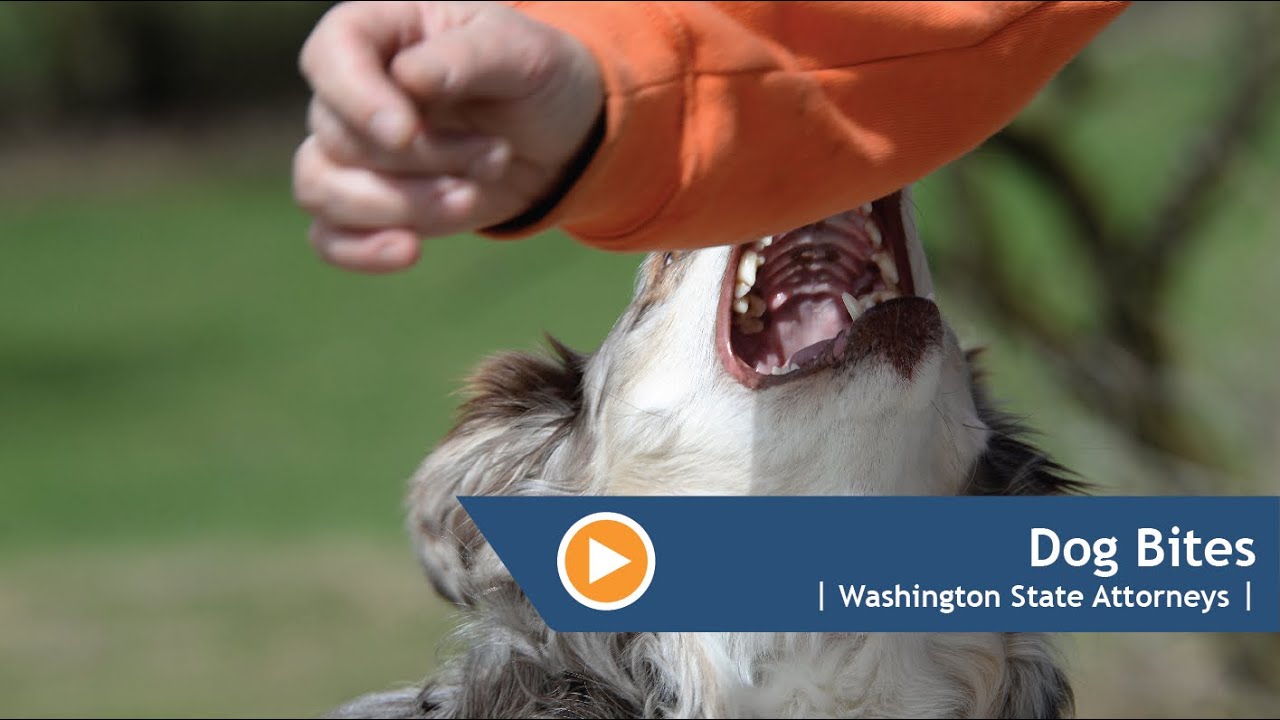 Learn Washington's Legal Position on Dog Bites