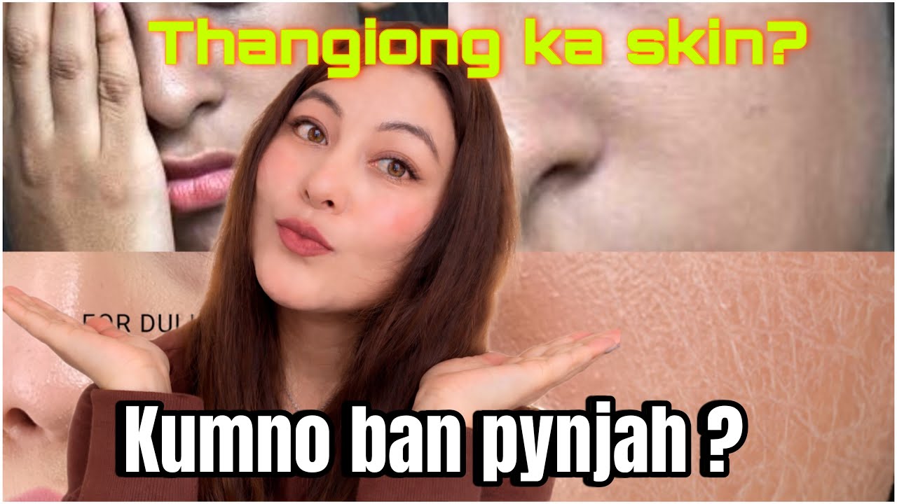 Kumno ba sumar ia ka dur khmat lada ka thangiong | da kaei ban tah ban ioh ka skin ba kham shai