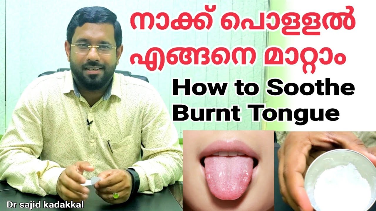 How to Soothe Burnt Tongue, നാക്ക് പൊളളൽ മാറ്റാൻ ഒരു ഹോം റെമഡി പരിചയപെടാം, Tongue Burnt Home Remedy
