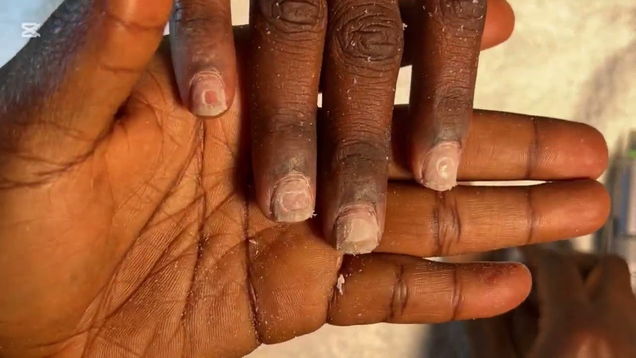 How to Remove Your Nails Properly &mdash; Safe & Simple (Press-ons, Gel + Aftercare)