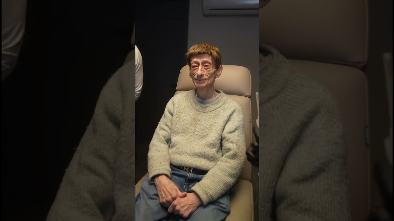 So emotional kann Beauty sein: die Radiesse Behandlung von Heinz-Jürgen!