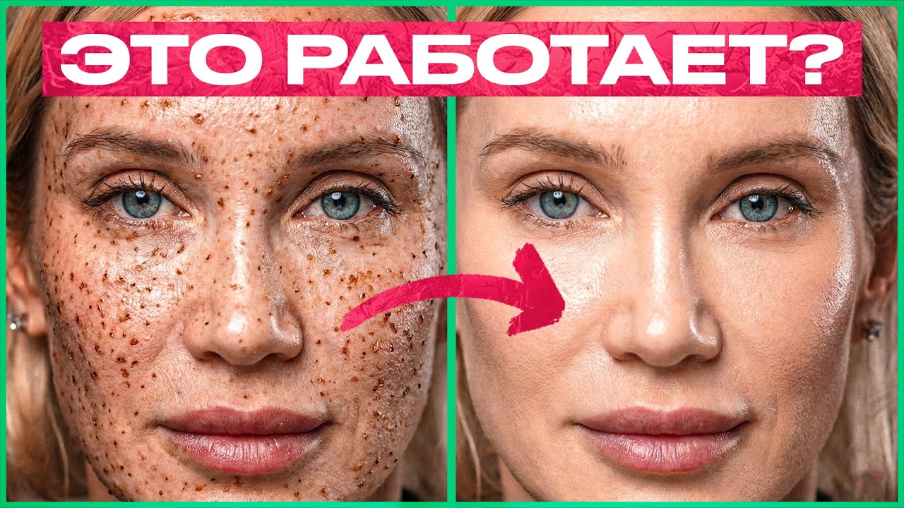 Холодная плазма: откровение косметолога... Да, я переобулась!
