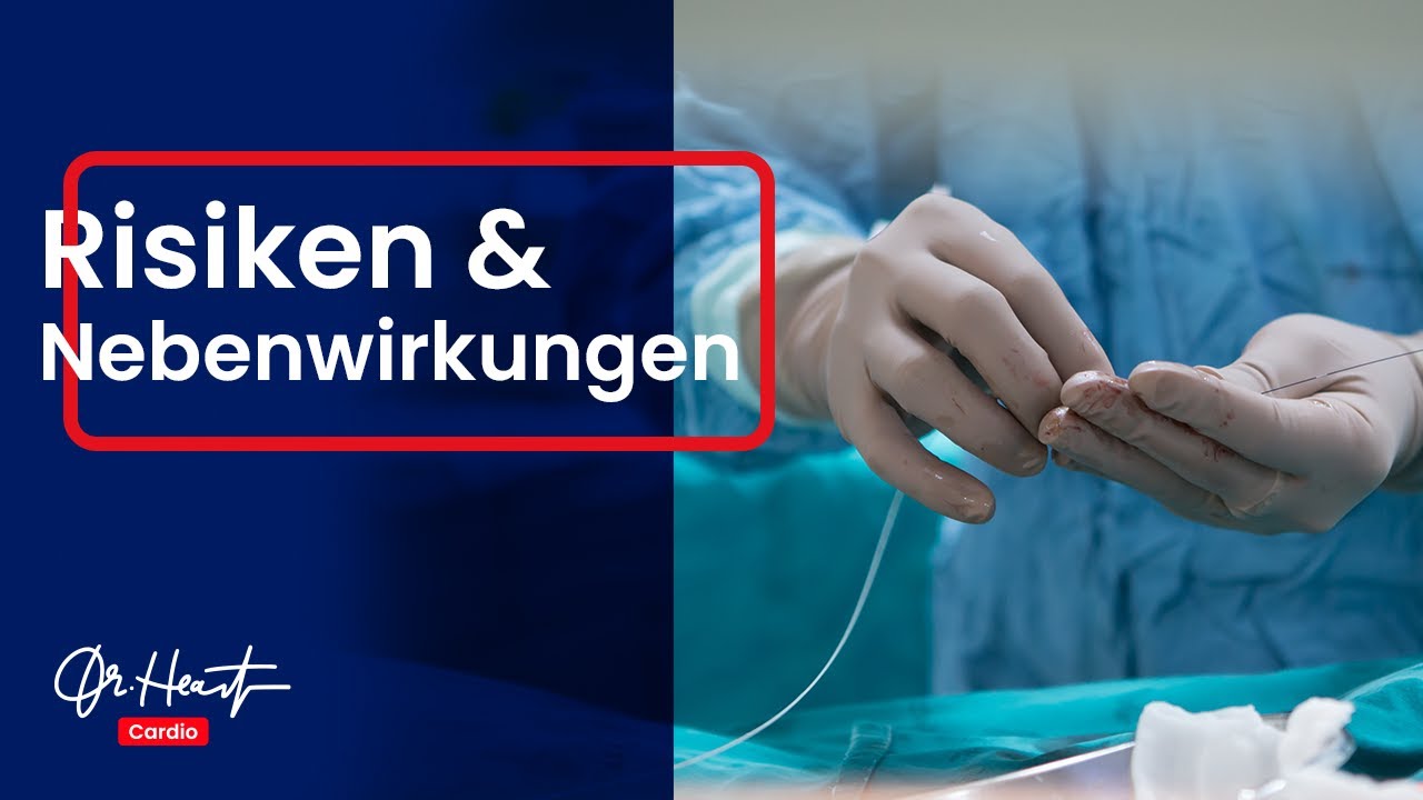Herzkatheter - Risiken und Nebenwirkungen | Dr.Heart