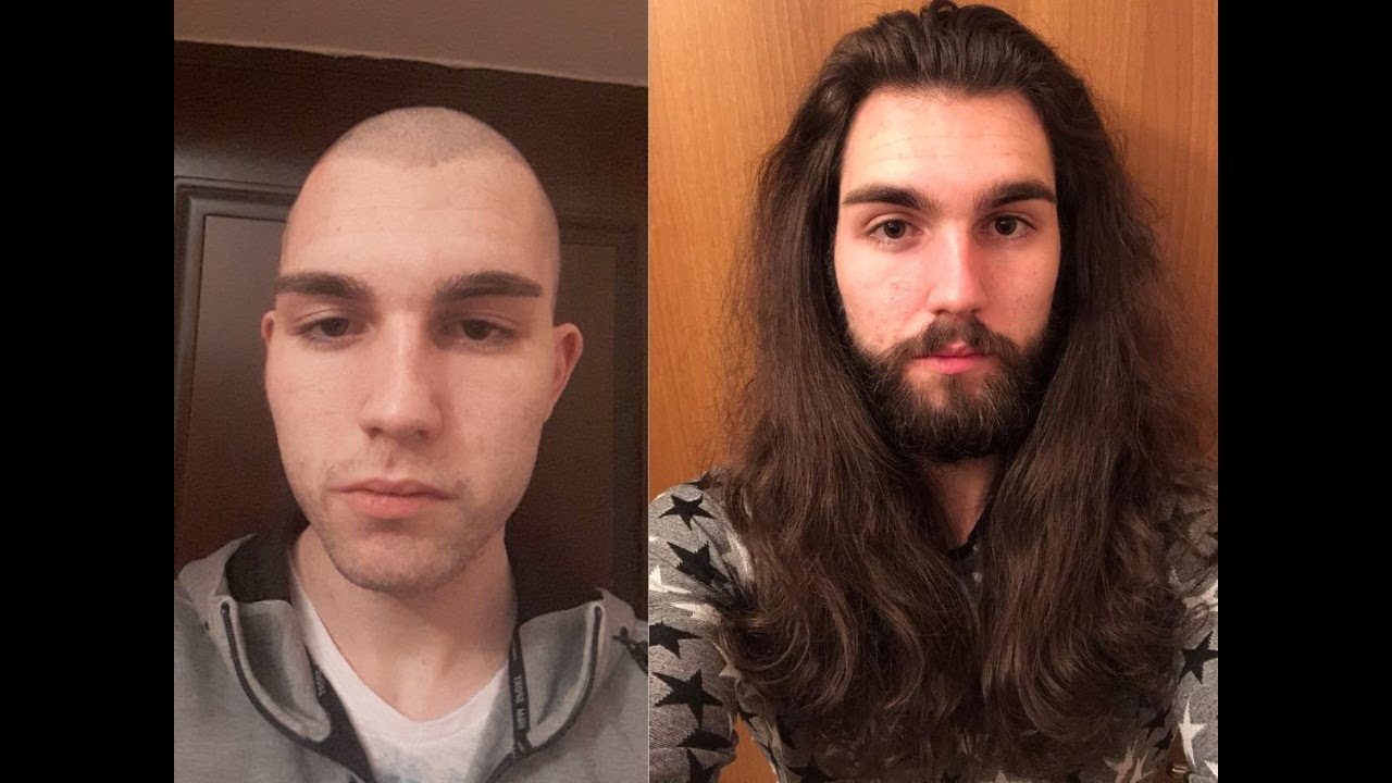 How I became Jesus Part 2 (3 year hair growth timelapse)