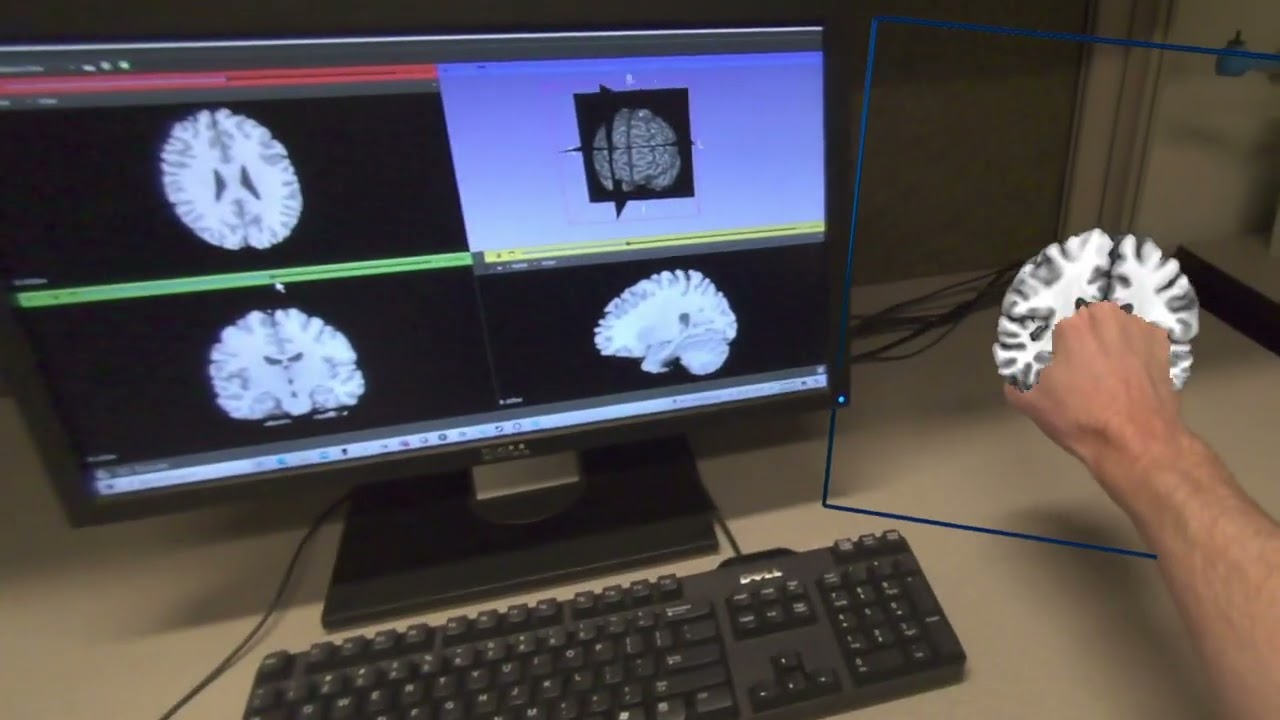 NeuroCR: Integrating Mixed Reality with Desktop Medical Imaging Software - IEEE VR 2025