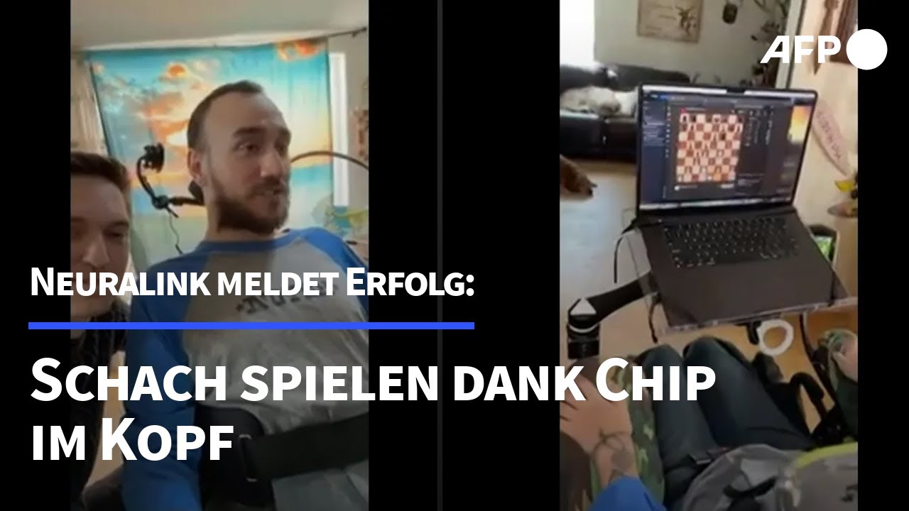 Schach spielen dank Chip im Kopf | AFP
