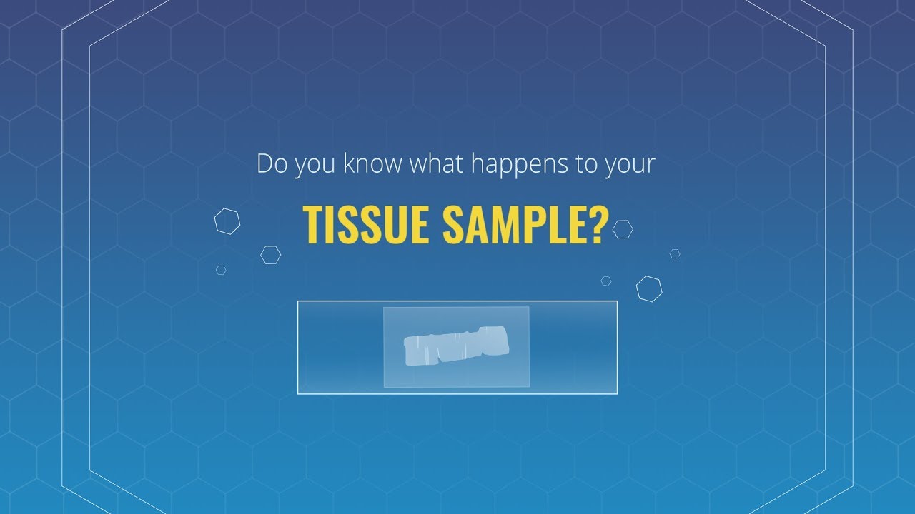 Do you know what happens to your tissue sample?