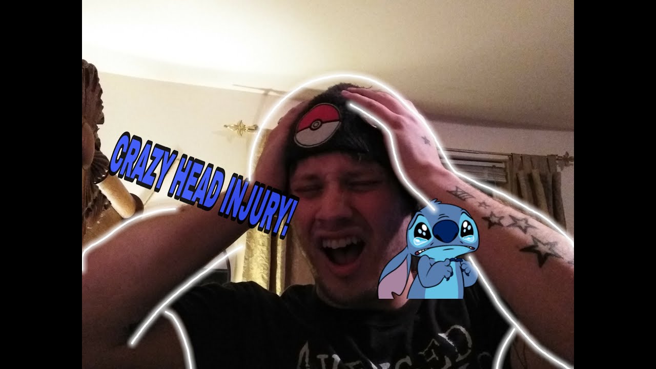 I GOT HIT IN THE HEAD WITH A BASEBALL BAT! Storytime #1