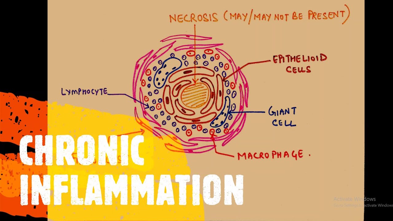 GENERAL PATHOLOGY II CHAPTER 3 II INFLAMMATION II CHRONIC INFLAMMATION II ROBBINS 10TH EDITION II
