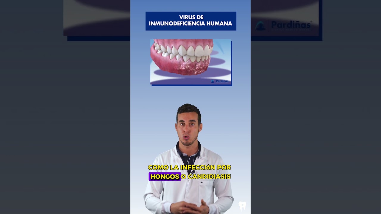 As&iacute; afecta el VIH a la SALUD ORAL