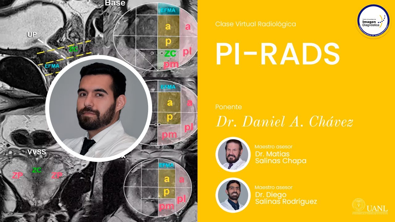 PI-RADS