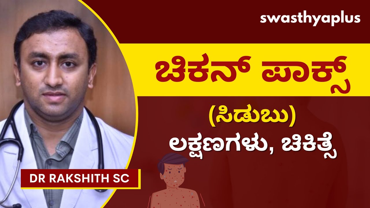ಚಿಕನ್ಪಾಕ್ಸ್: ಹೇಗೆ ಚಿಕಿತ್ಸೆ ನೀಡಬೇಕು? | Treatment of Chicken Pox, in Kannada | Dr Rakshith SC