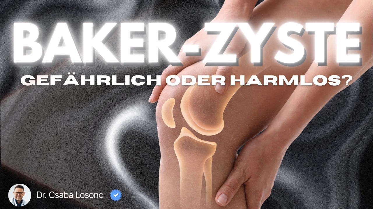 Bakerzyste gefährlich? Warum du sie nicht ignorieren darfst!