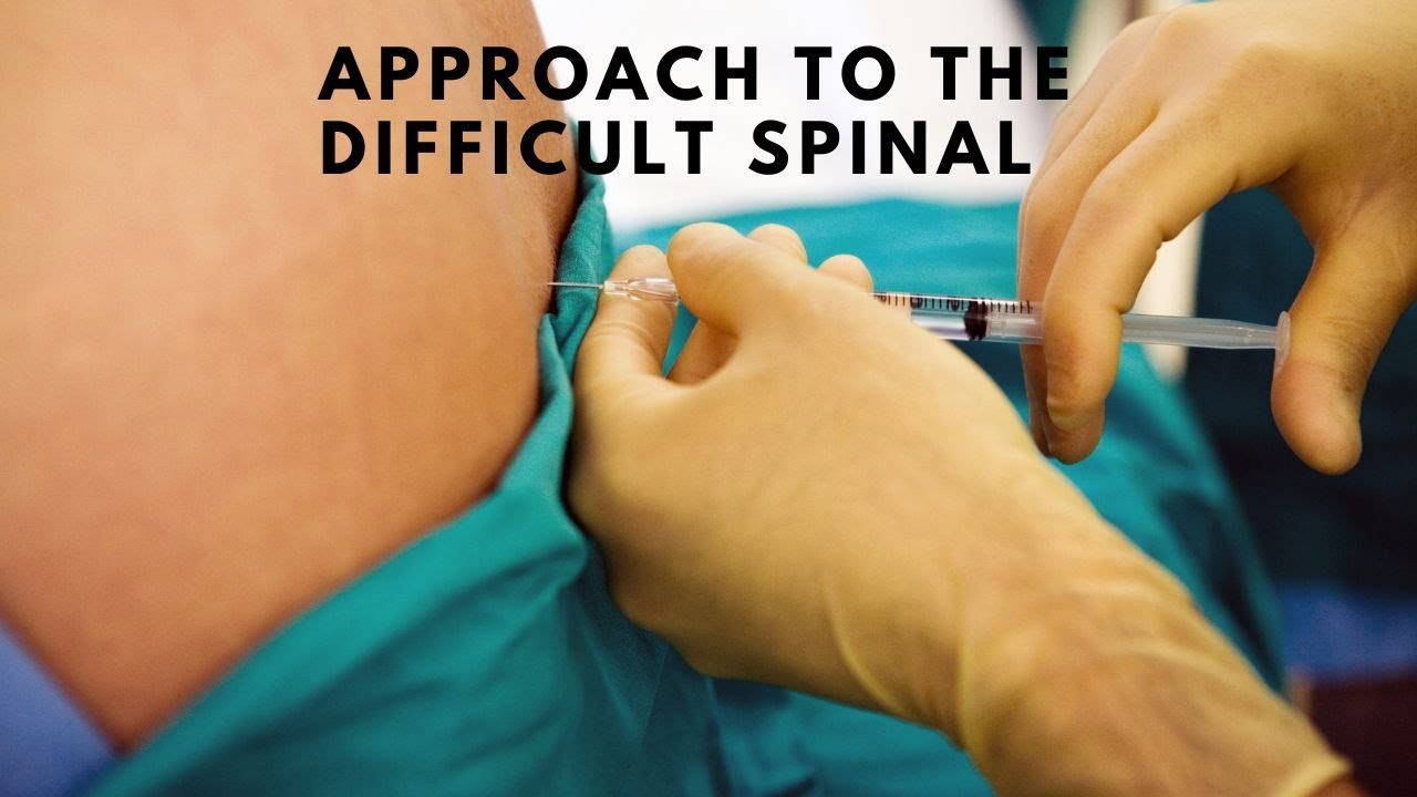 Approach to the difficult spinal