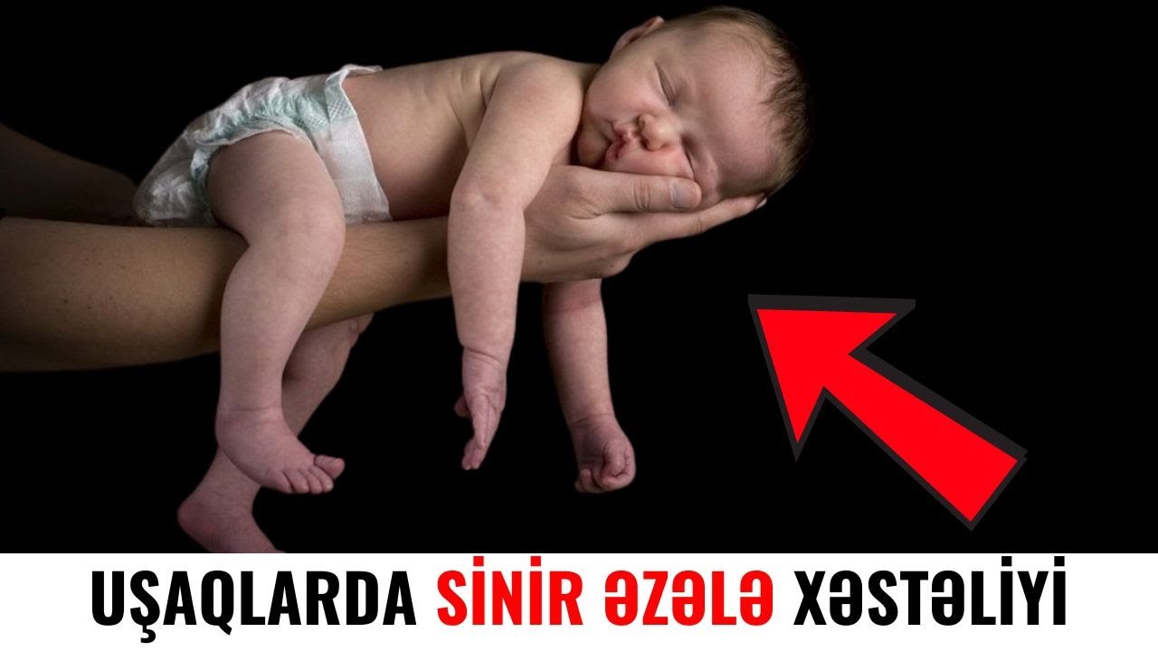 Uşaqlarda sinir əzələ xəstəliyin əlamətləri nələrdir?
