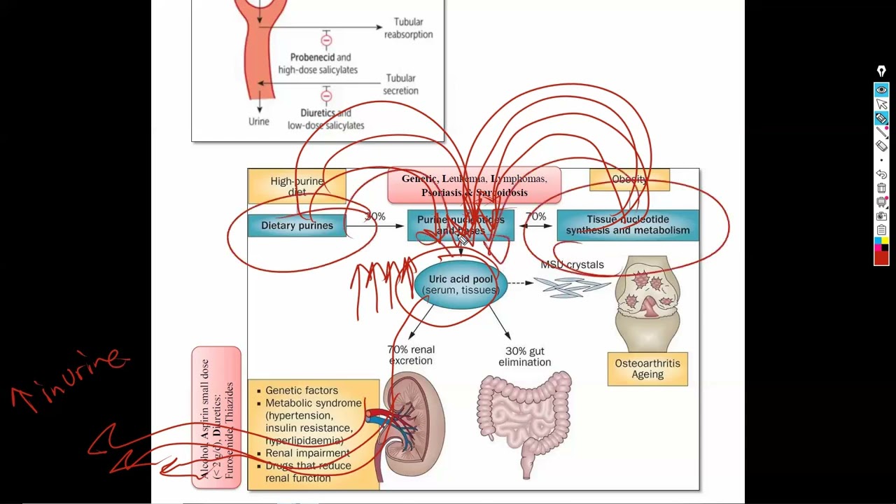 4-Gout, joint & bone diseases شرح باطنة دكتور سويلم
