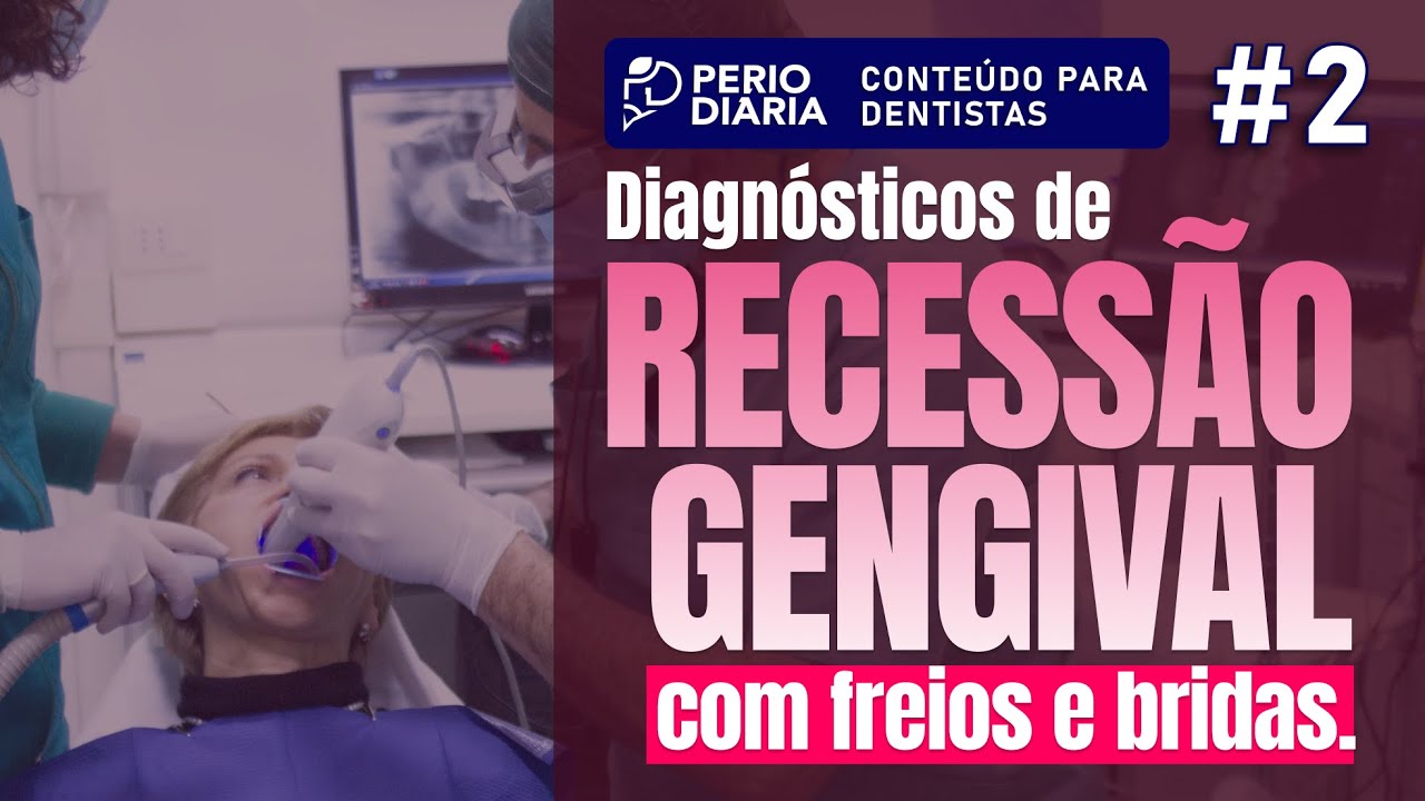 #2 -  RECESSÃO gengival com FREIOS e BRIDAS... Todo dentista tem que dominar!