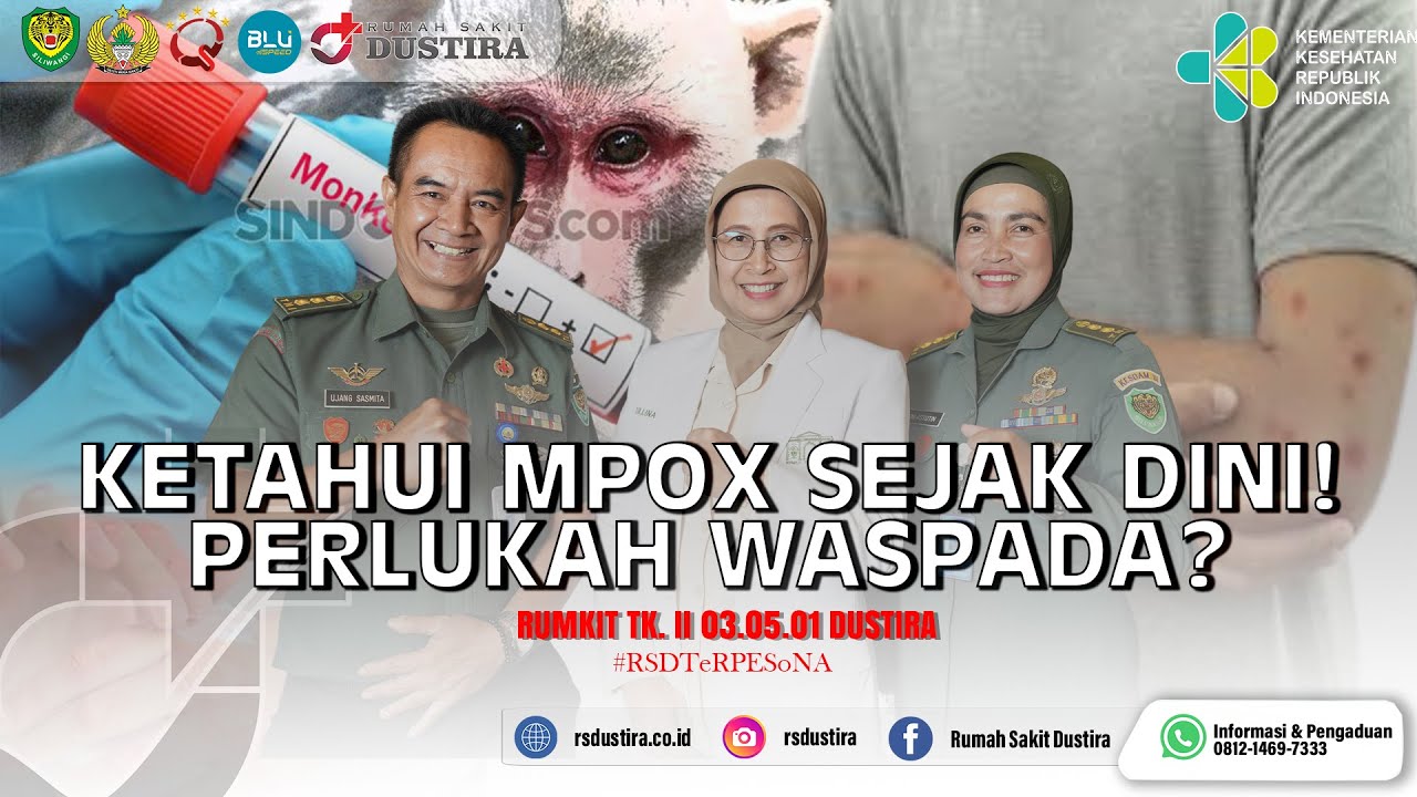 Kenali MPOX Sejak Dini! Perlukah Waspada??