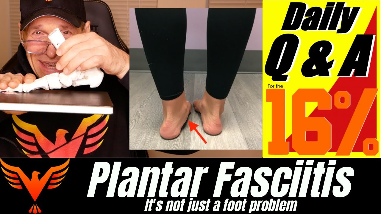 Plantar Fasciitis - It's Not Just a Foot Problem - BillHartmanPT.com Q&A for The 16%