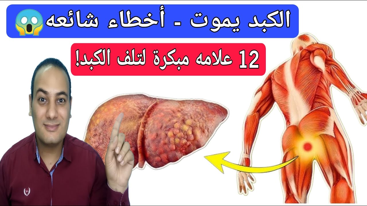 انتبه.. 12 علامات غريبة تكشف انك تعاني تلف الكبد موت الكبد! أفضل طعام للكبد وازاله سموم الكبد!