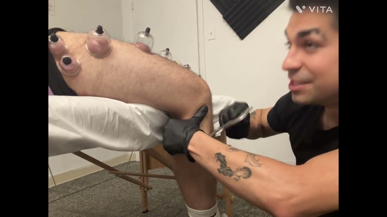 Bodywork ON RUNNERS KNEE 