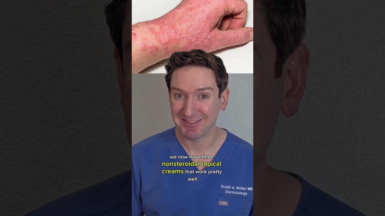 Is it the END of STEROID CREAMS for ECZEMA? #eczema #steroid #derm