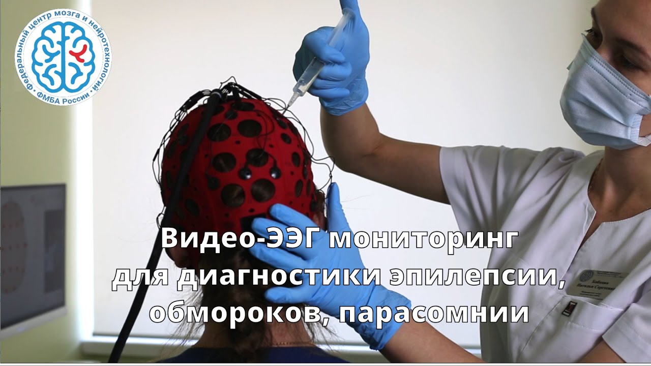 Видео-ЭЭГ мониторинг для диагностики эпилепсии, обмороков, парасомнии
